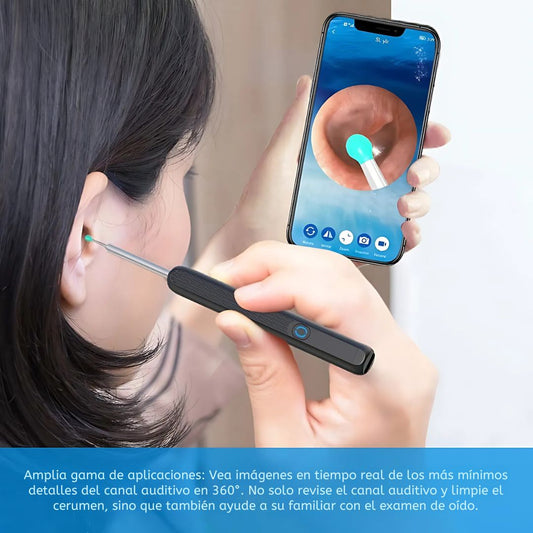 📲Cámara limpiadora de oídos🦻 HD + LED – 🔍40% DCTO por tiempo limitado