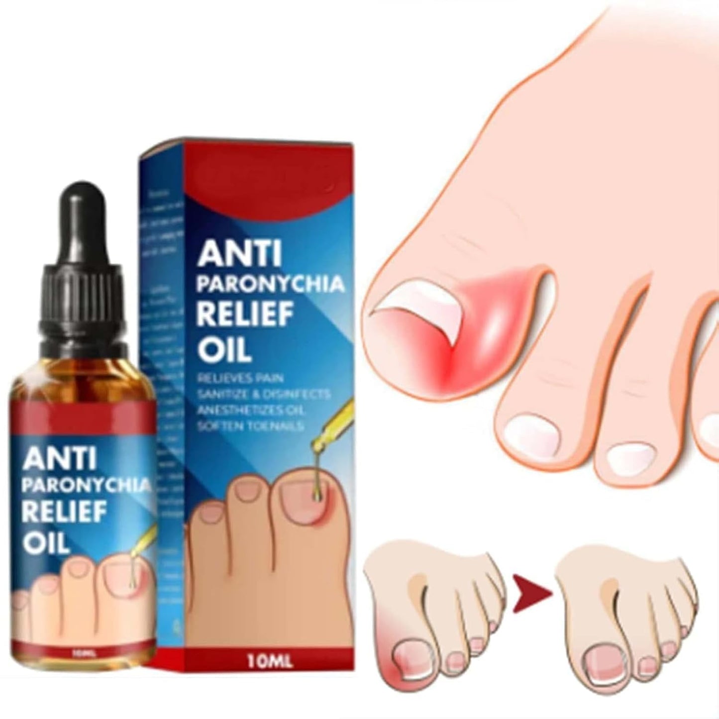 ¡ToenailPlus ! 🇩🇪 Aceite que elimina hongos, paroniquia y uñas encarnadas. Paga 1 Lleva 2 (Solo por Hoy)